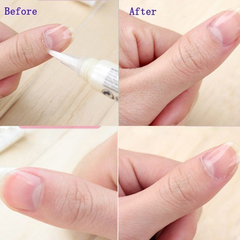 1pcs Cuticle Oil Pen Nail Nutr - Nutrition & Fitness Station 评论和价格